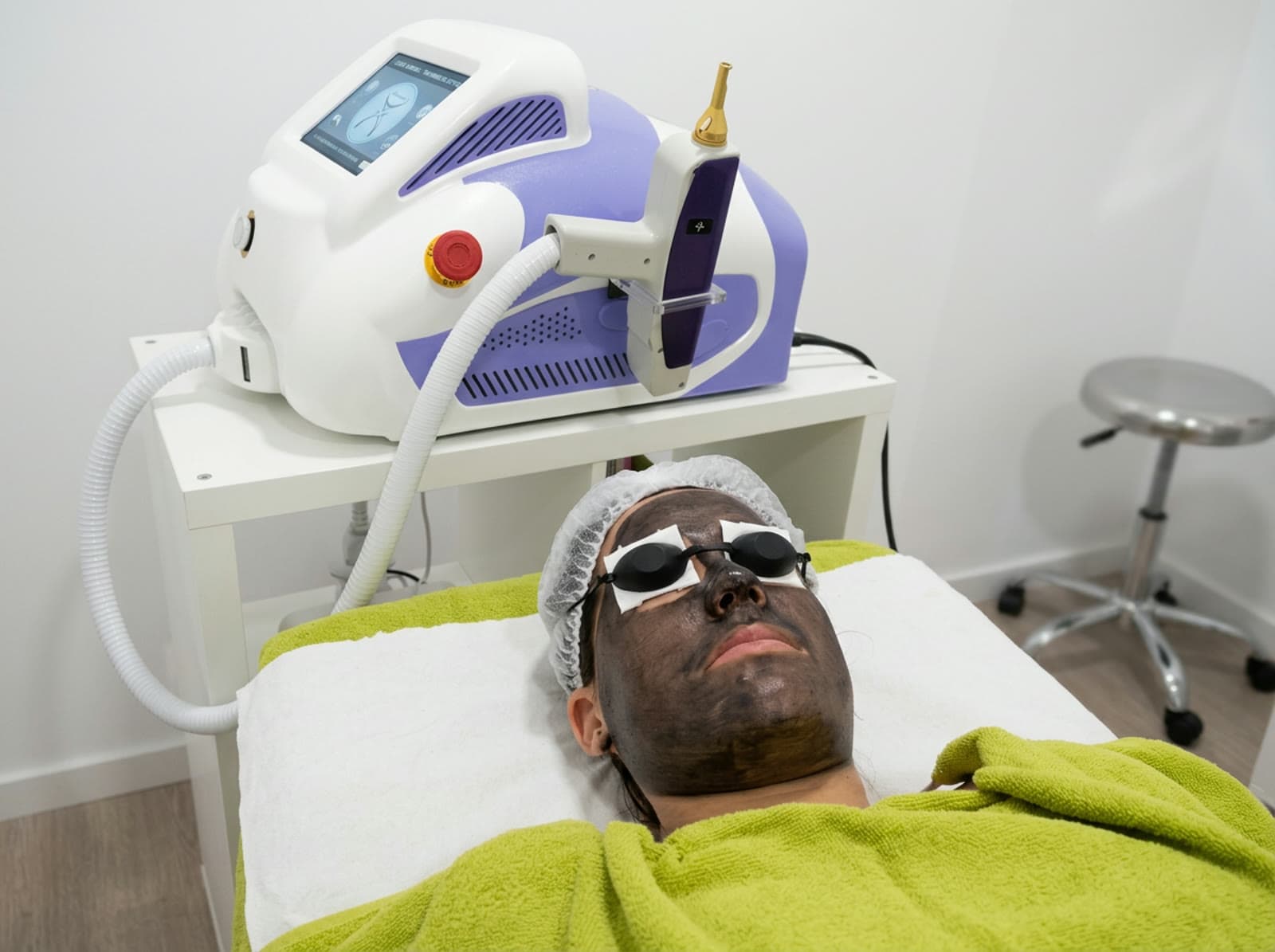 Tratamiento con láser Q-Switched para eliminar tatuajes